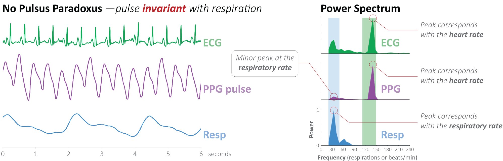 No pulsus paradoxus: time domain waveforms and power spectrum showing pulse invariant with respiration