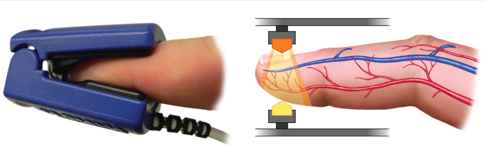 Standard pulse oximeter finger probe and diagram showing light transmission through arterial blood
